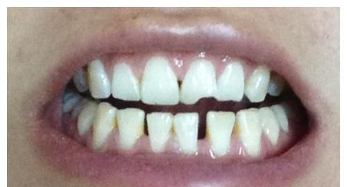 加速男性衰老的行为被发现,这6个行为习惯,或要及时改一改休闲区蓝鸢梦想 - Www.slyday.coM 加速男性衰老的行为被发现,这6个行为习惯,或要及时改一改休闲区蓝鸢梦想 - Www.slyday.coM