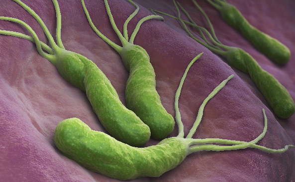 幽门螺旋杆菌是一种螺旋形,微厌氧,对生长条件要求十分苛刻的细菌,常