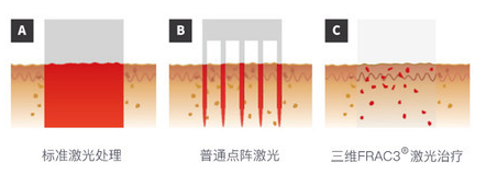 深度揭秘（护肤品真的能抗衰老吗知乎）知乎护肤品真的可以延缓衰老吗，知乎这个关于抗衰的问题火了！真正有效的「抗衰秘籍」,你学会了吗?，戒色头发会恢复吗知乎文章，