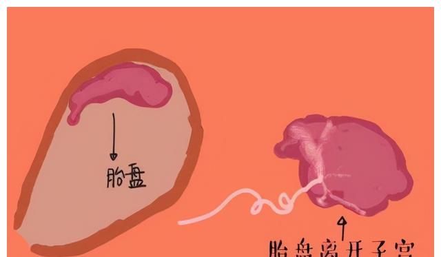 人体胎盘有人视若珍宝有人嗤之以鼻带您揭开它的真面目