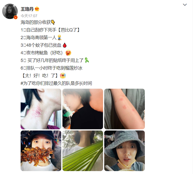 王珞丹自曝被咬48个蚊子包在脖子上刮痧素颜逛夜市吃烤鱿鱼