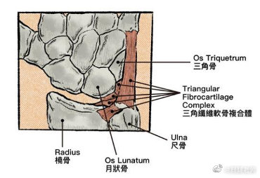 手腕三角软骨损伤怎样治疗 三角软骨损伤能自愈吗