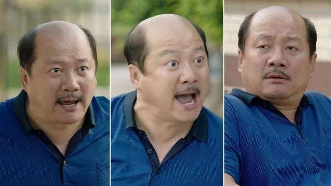 关于掉发这件事……|头发|扎心|谢广坤_新浪新闻