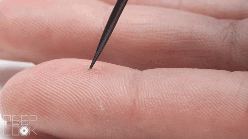 为什么刺入皮肤的豪猪刺难以拔出来