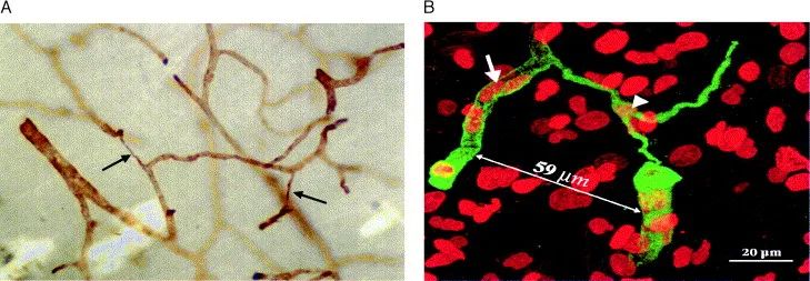 警惕！最新研究表明，新冠后遗症会造成大脑萎缩，轻症也不例外！休闲区蓝鸢梦想 - Www.slyday.coM