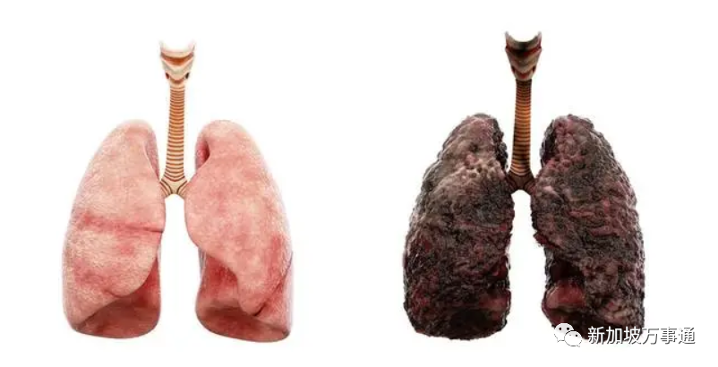 新冠后遗症新发现：病毒或加速大脑萎缩、或使人提前衰老1休闲区蓝鸢梦想 - Www.slyday.coM