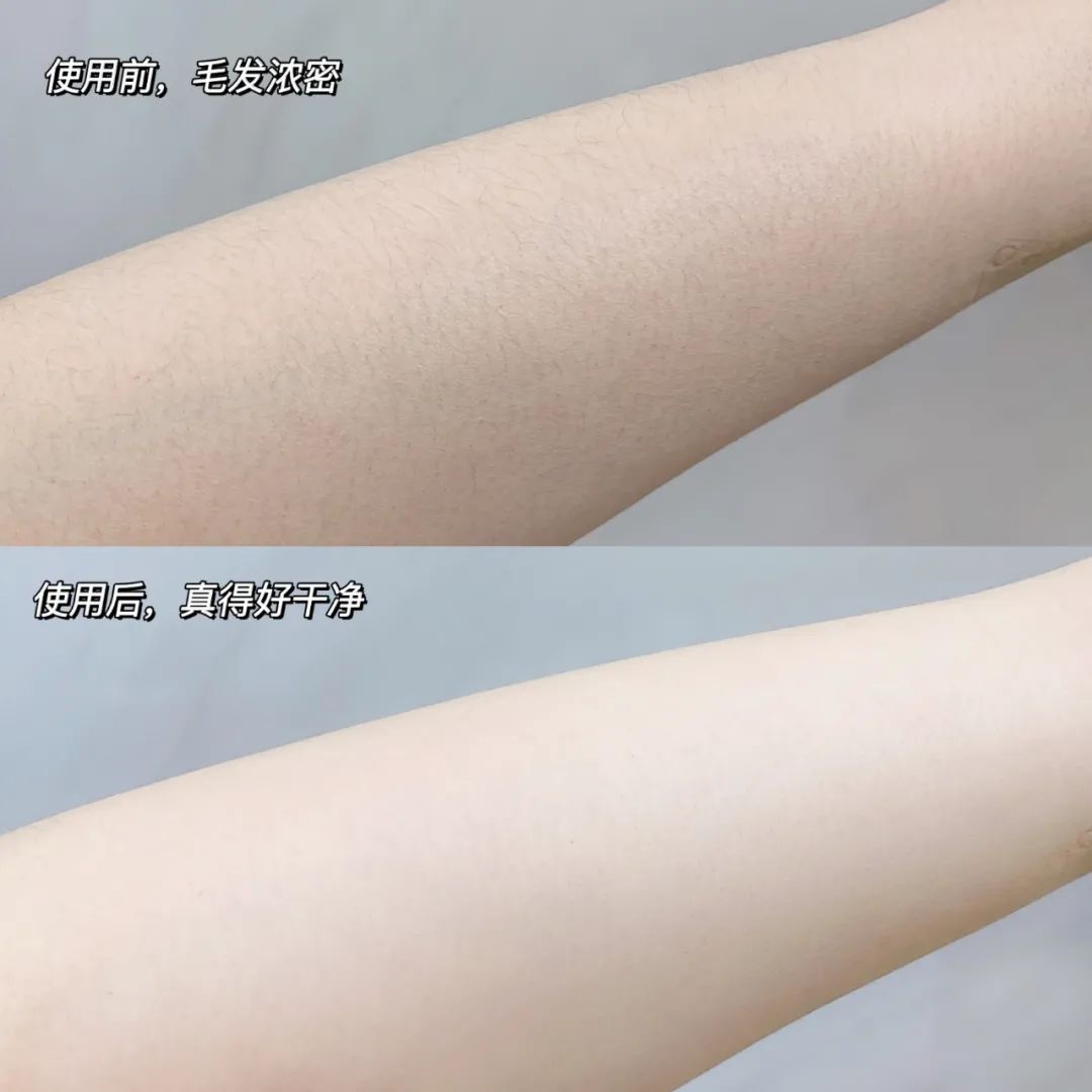 速看夏日必备神器5分钟告别毛手毛脚你准备好脱了吗