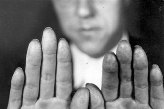 指纹真的能决定人生吗?民间流传“一斗穷二斗富”,是真是假?休闲区蓝鸢梦想 - Www.slyday.coM 指纹真的能决定人生吗?民间流传“一斗穷二斗富”,是真是假?休闲区蓝鸢梦想 - Www.slyday.coM