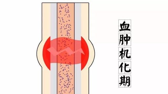 同样是骨,为何有些能劈砖裂石?|骨骼|骨折|骨痂_新浪新闻
