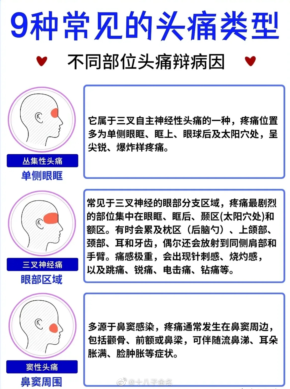 9种不同部位的头痛原因缓解头疼的十个小妙招建议收藏起来