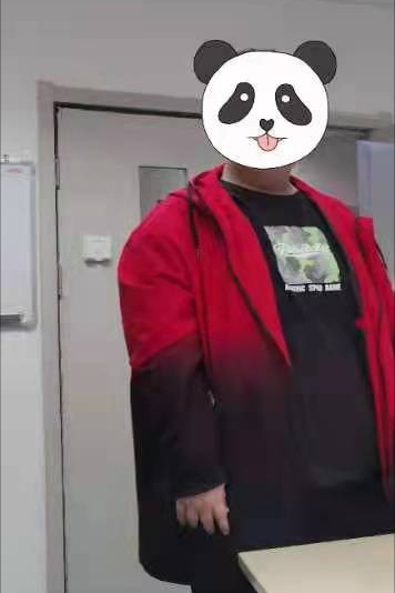 东院胃肠外科,减重与代谢外科主任教授罗建飞是全国有名的减重专家,特