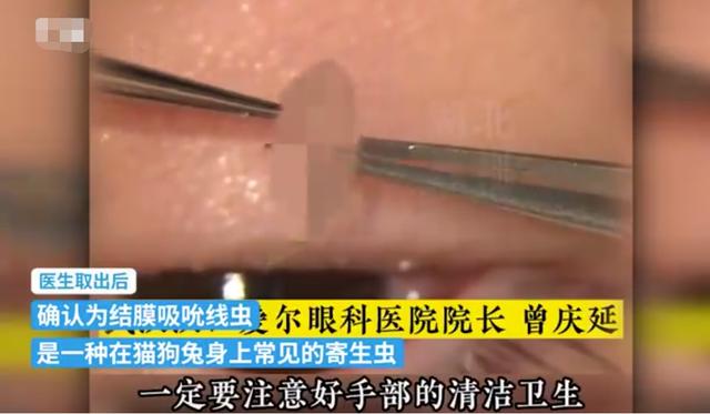 2岁女童眼里惊现6条活虫！医院检查发现，原来是因为家里养了这休闲区蓝鸢梦想 - Www.slyday.coM