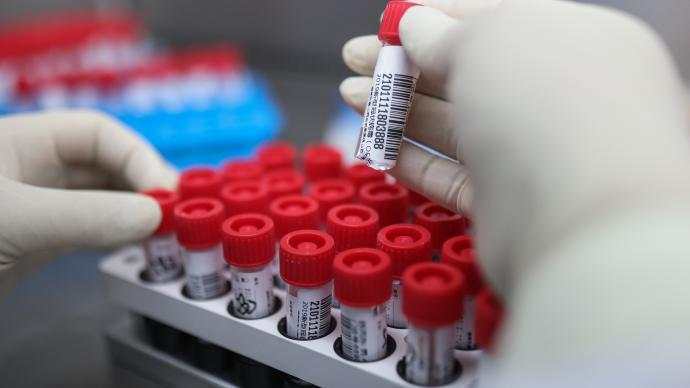 大连在风险人员排查中发现16个混管样本结果异常休闲区蓝鸢梦想 - Www.slyday.coM