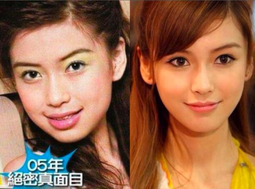 杨颖15年前视频曝光整没整容一目了然换头传言夸张了