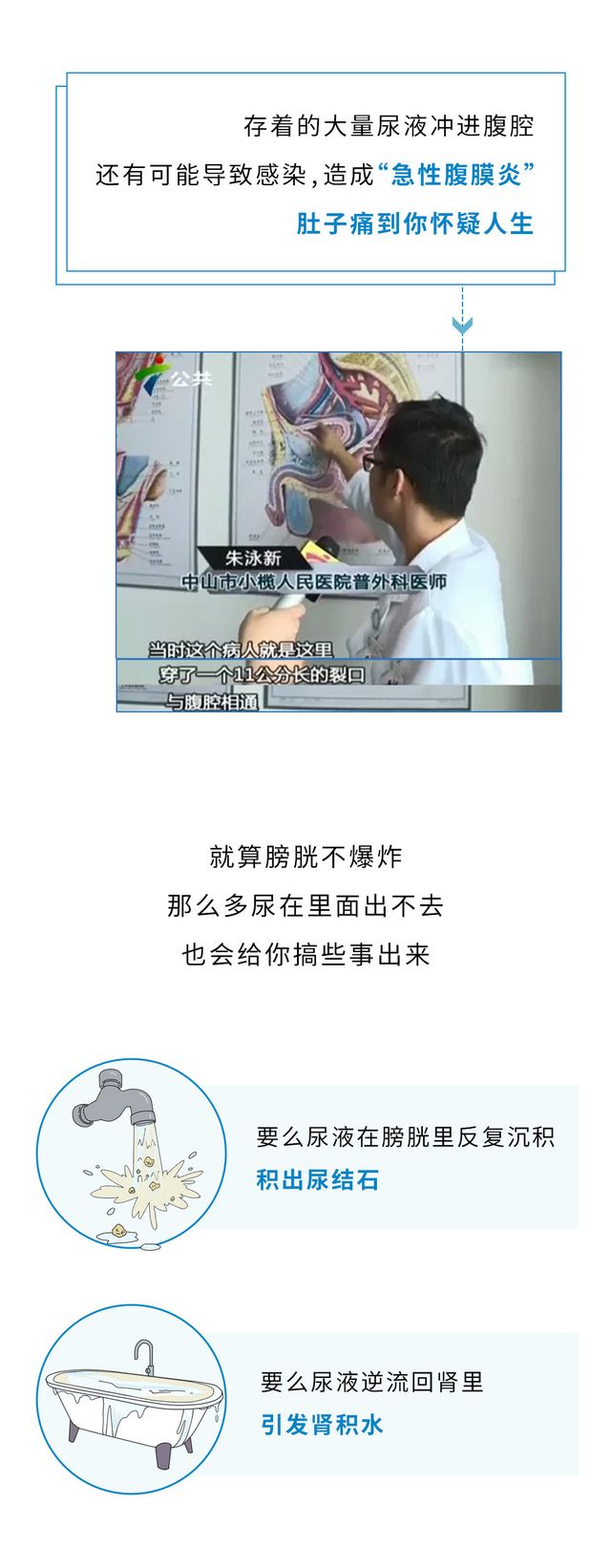 憋屎、憋尿、憋屁,哪个对身体危害最大?一幅漫画为你揭秘休闲区蓝鸢梦想 - Www.slyday.coM 憋屎、憋尿、憋屁,哪个对身体危害最大?一幅漫画为你揭秘休闲区蓝鸢梦想 - Www.slyday.coM