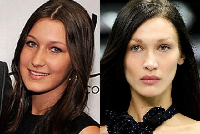 超模贝拉哈迪德承认整容14岁时改造了鼻子妈妈遭抨击