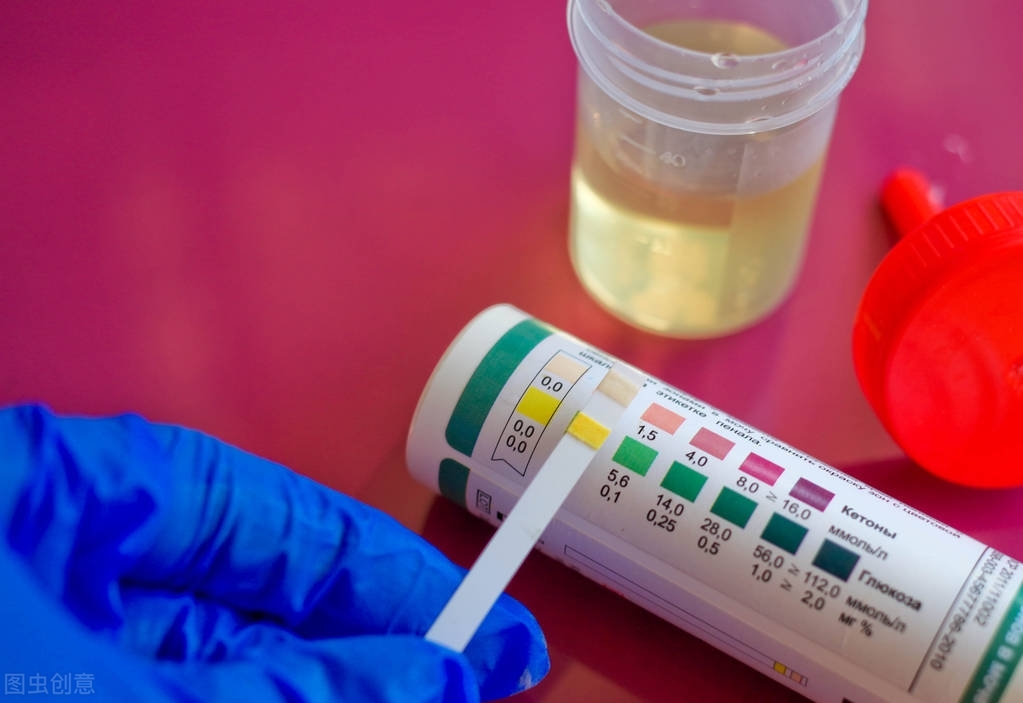 尿酸过低的危害整理,村医收藏|抗氧化|尿酸|血症_新浪新闻