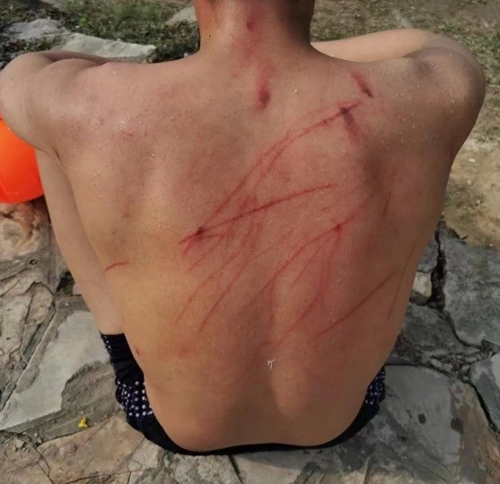 又惨又好笑！男子在南师大湖中游泳被黑天鹅制裁，惹谁也别惹鹅啊！休闲区蓝鸢梦想 - Www.slyday.coM