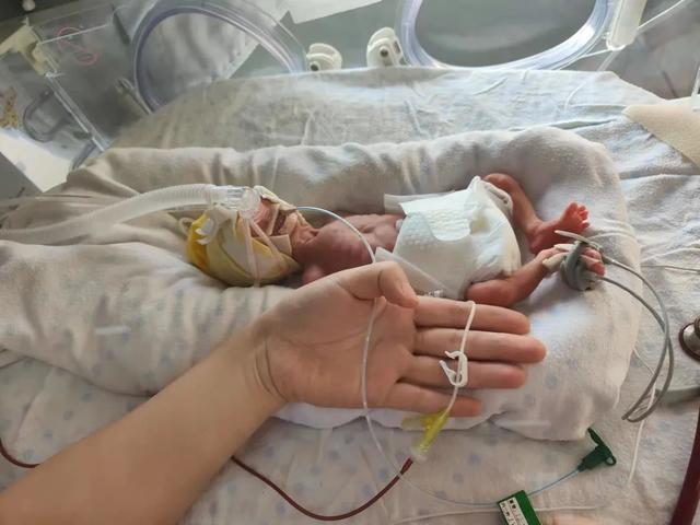 小乖长成大宝这位超低体重早产儿近日在河南大学淮河医院出院了