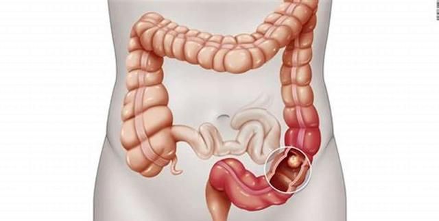 胃部位置图片图片