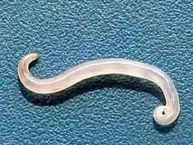 4岁男孩深夜腹痛,肛门爬出20多只小虫子,医生:不注意卫生引起|蛲虫_新