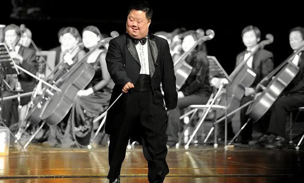 01:舟舟的天才骗局:奇迹是假的,但爱是真的"唐氏宝宝"就是这类特殊的