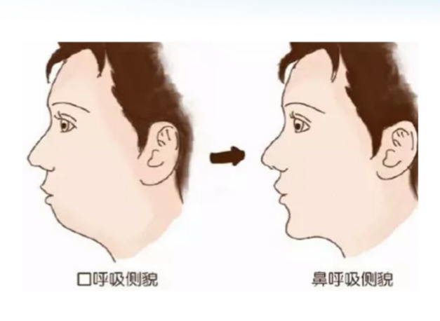 打鼾是一种病快来南山医院领取睡眠日健康大礼包