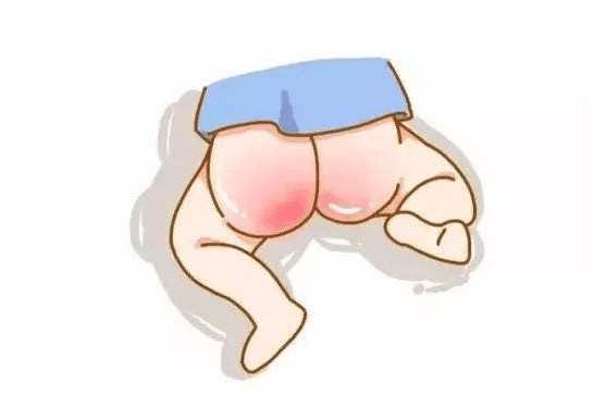 如何预防和护理红屁屁