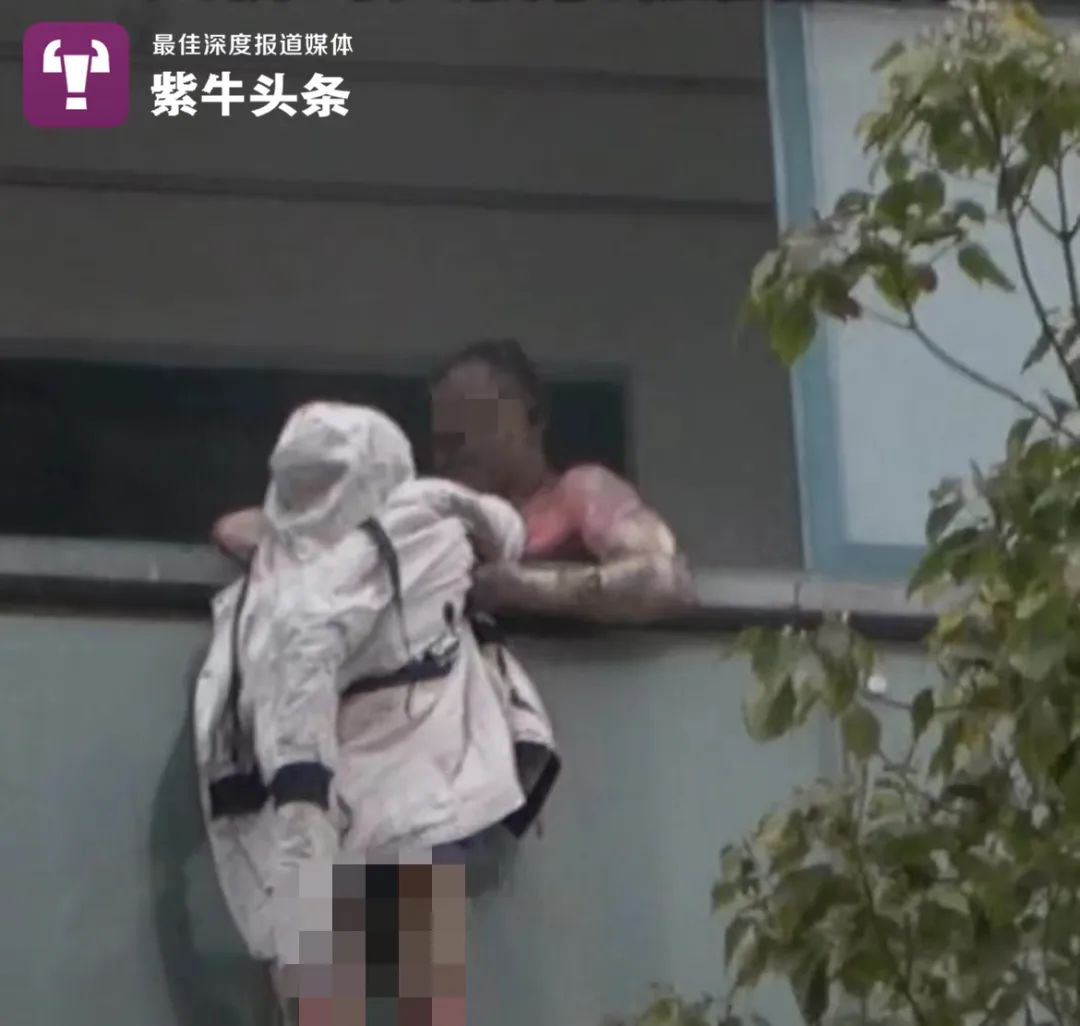 【紫牛头条】火灾中舍身护妻的丈夫走了，妻子第二次手术结束，情况良好休闲区蓝鸢梦想 - Www.slyday.coM