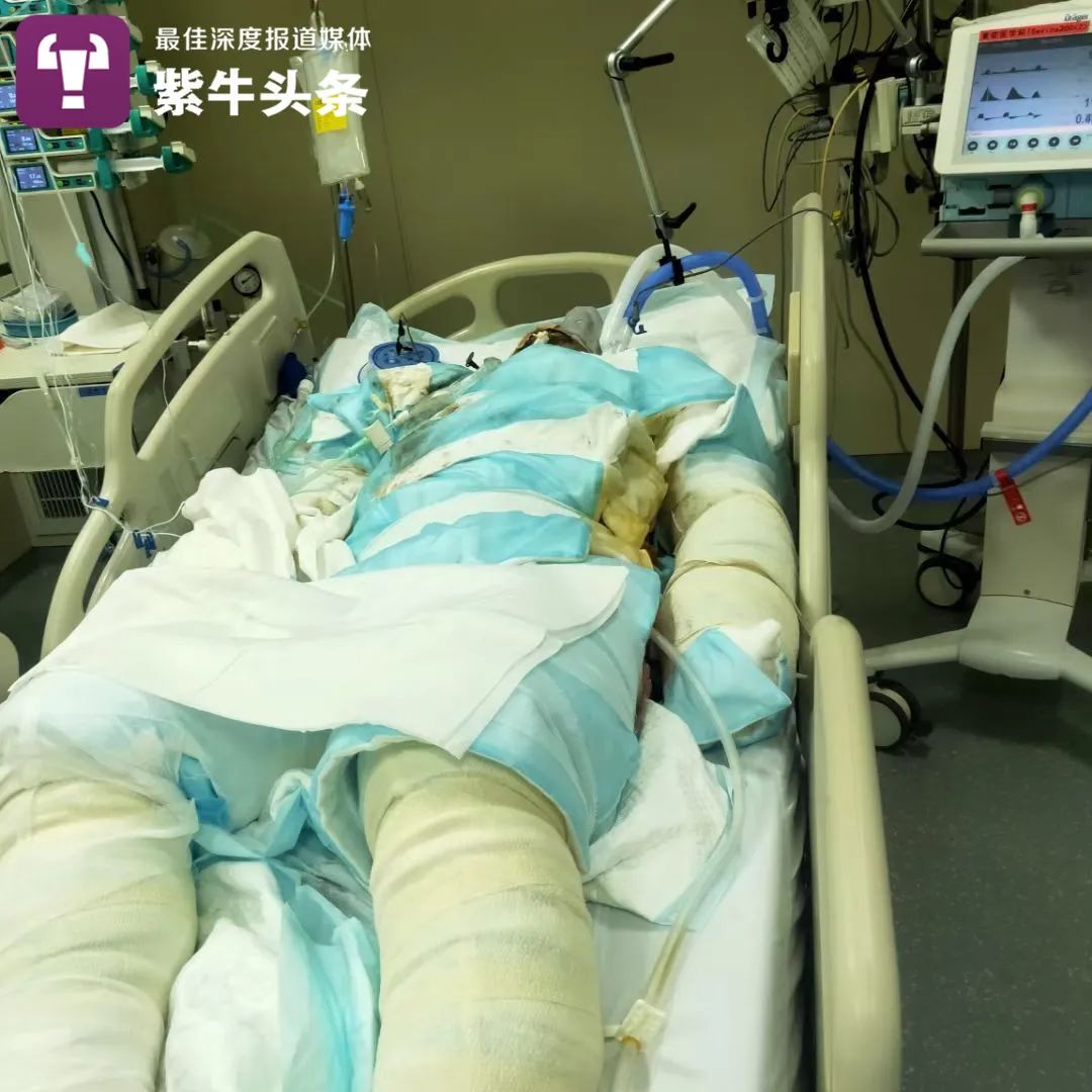 【紫牛头条】火灾中舍身护妻的丈夫走了，妻子第二次手术结束，情况良好休闲区蓝鸢梦想 - Www.slyday.coM