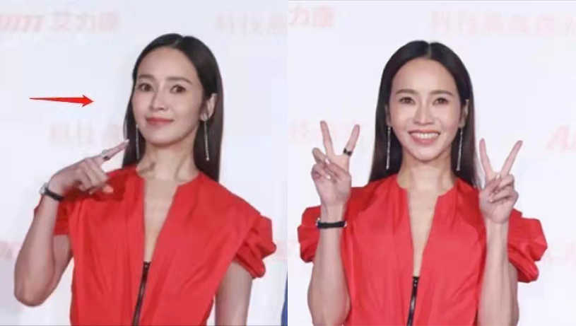 侯佩岑面部僵硬大变样，颜值被林心如秒杀，同框都输给林志颖休闲区蓝鸢梦想 - Www.slyday.coM