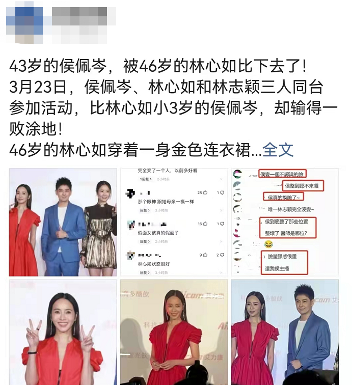 侯佩岑面部僵硬大变样，颜值被林心如秒杀，同框都输给林志颖休闲区蓝鸢梦想 - Www.slyday.coM