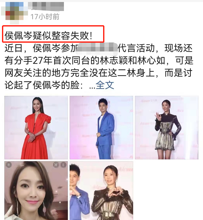 侯佩岑面部僵硬大变样，颜值被林心如秒杀，同框都输给林志颖休闲区蓝鸢梦想 - Www.slyday.coM