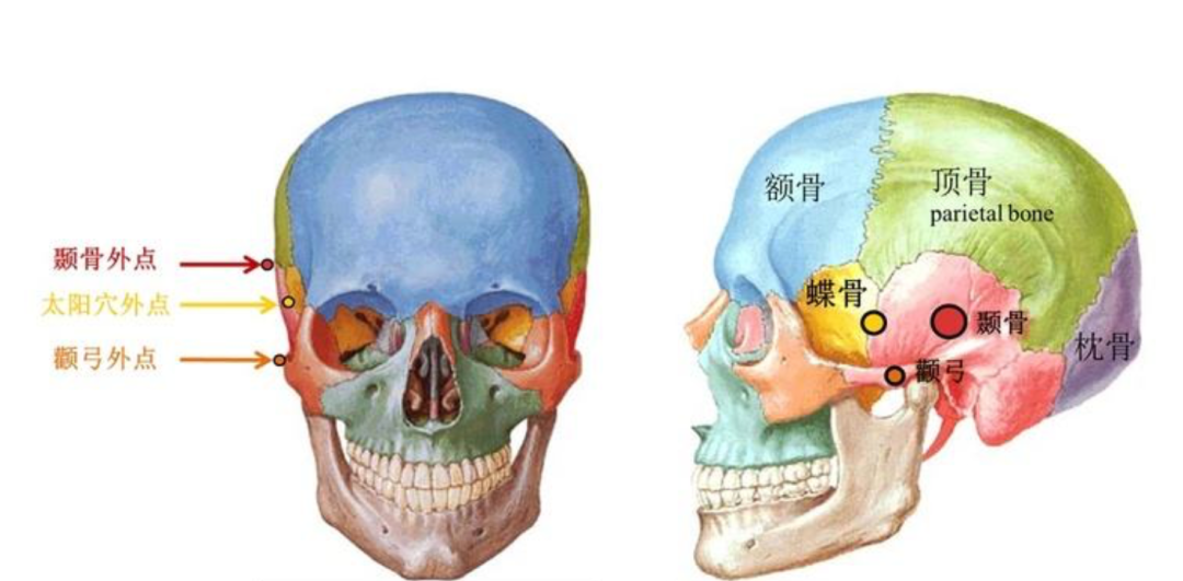 多数人主要还是因为皮下容积减少,换句话说就是衰老导致.