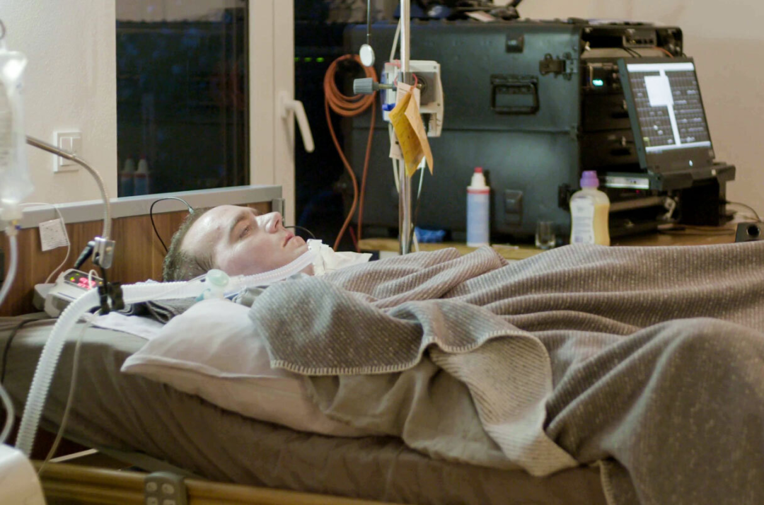 植入大脑电极晚期渐冻症患者通过神经信号交流匹配准确率80有效时间仅