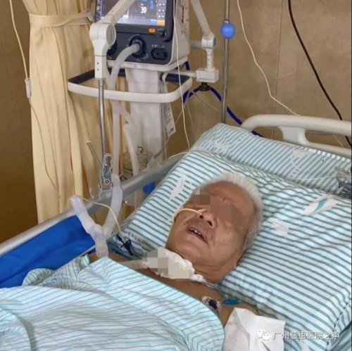 高压氧治疗脑梗死效果显著脑梗死患者康复出院