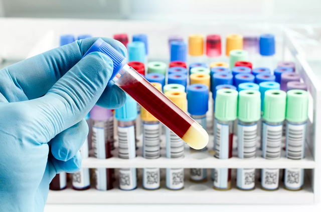 这是真的！微塑料正在吞噬人体，血液中首次发现它，影响有多大？休闲区蓝鸢梦想 - Www.slyday.coM