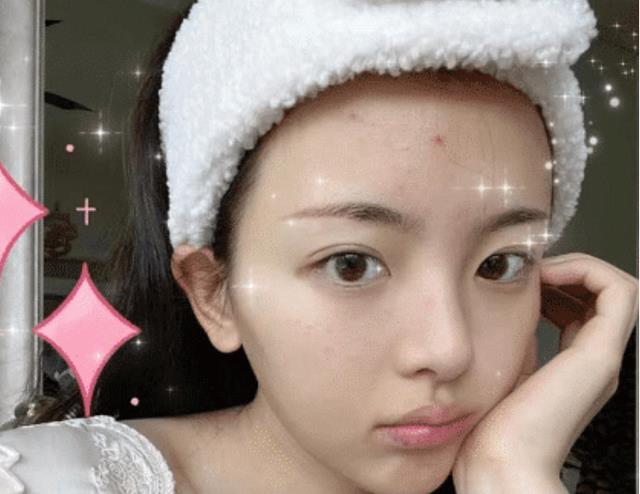 杨超越分享素颜自拍照脸部长痘略有瑕疵脸部线条清晰可见