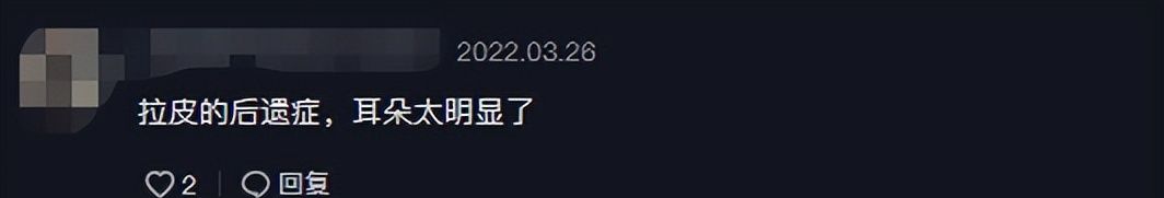 54岁伊能静晒自拍变化大！脸颊凹陷瘦脱相，霸气回怼对其外貌质疑休闲区蓝鸢梦想 - Www.slyday.coM