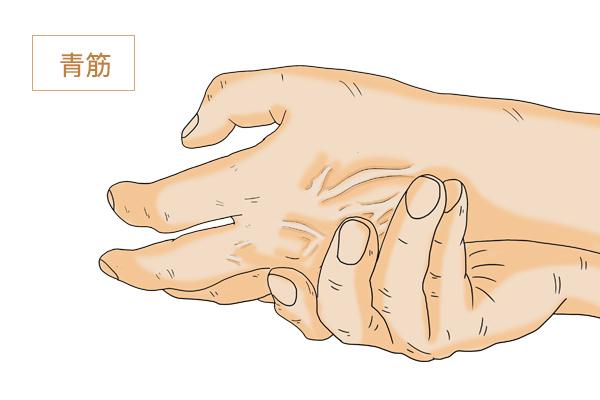 为什么有些人手上的青筋很明显凸起的青筋是好是坏公布答案