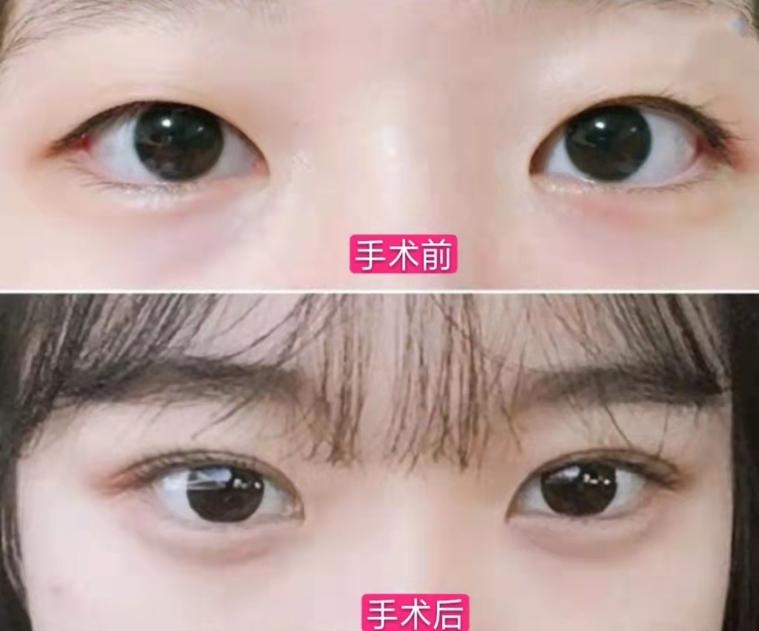 为了变美整成这样这种美你敢要吗
