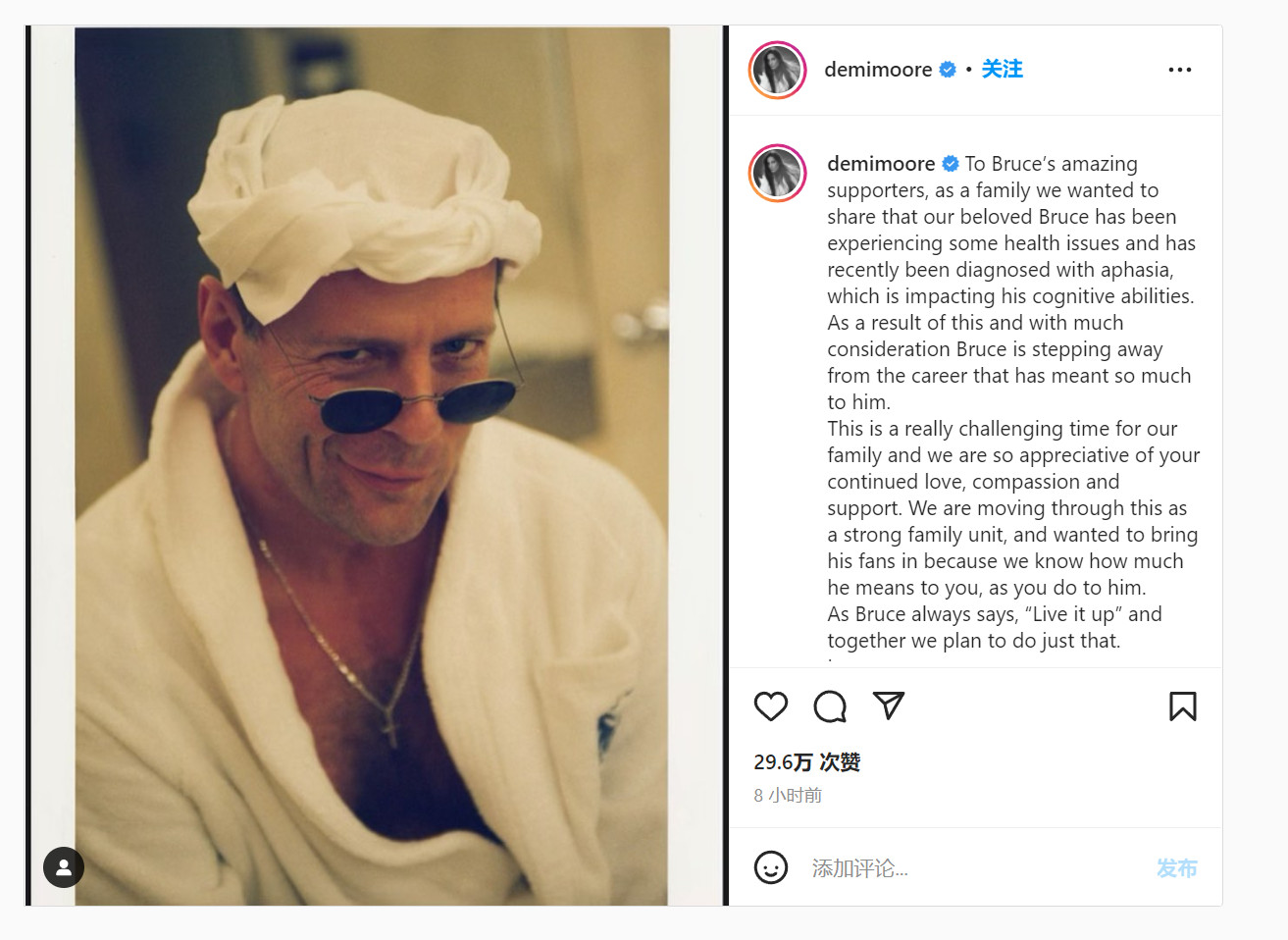 67岁的布鲁斯·威利斯宣布息影 患上失语症休闲区蓝鸢梦想 - Www.slyday.coM