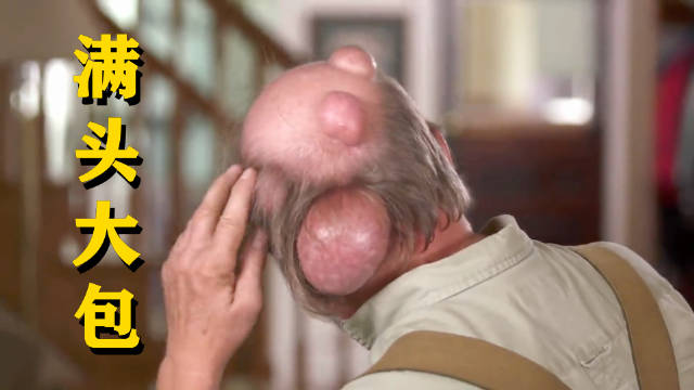 67岁大爷满头大包,一颗就有2斤重,切开直接喷黑水!