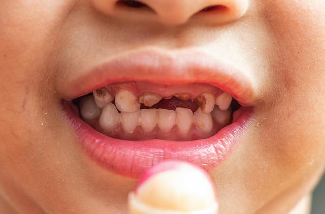 孩子睡觉爱“磨牙”？真相不一定是缺钙，这几个原因不要忽视休闲区蓝鸢梦想 - Www.slyday.coM
