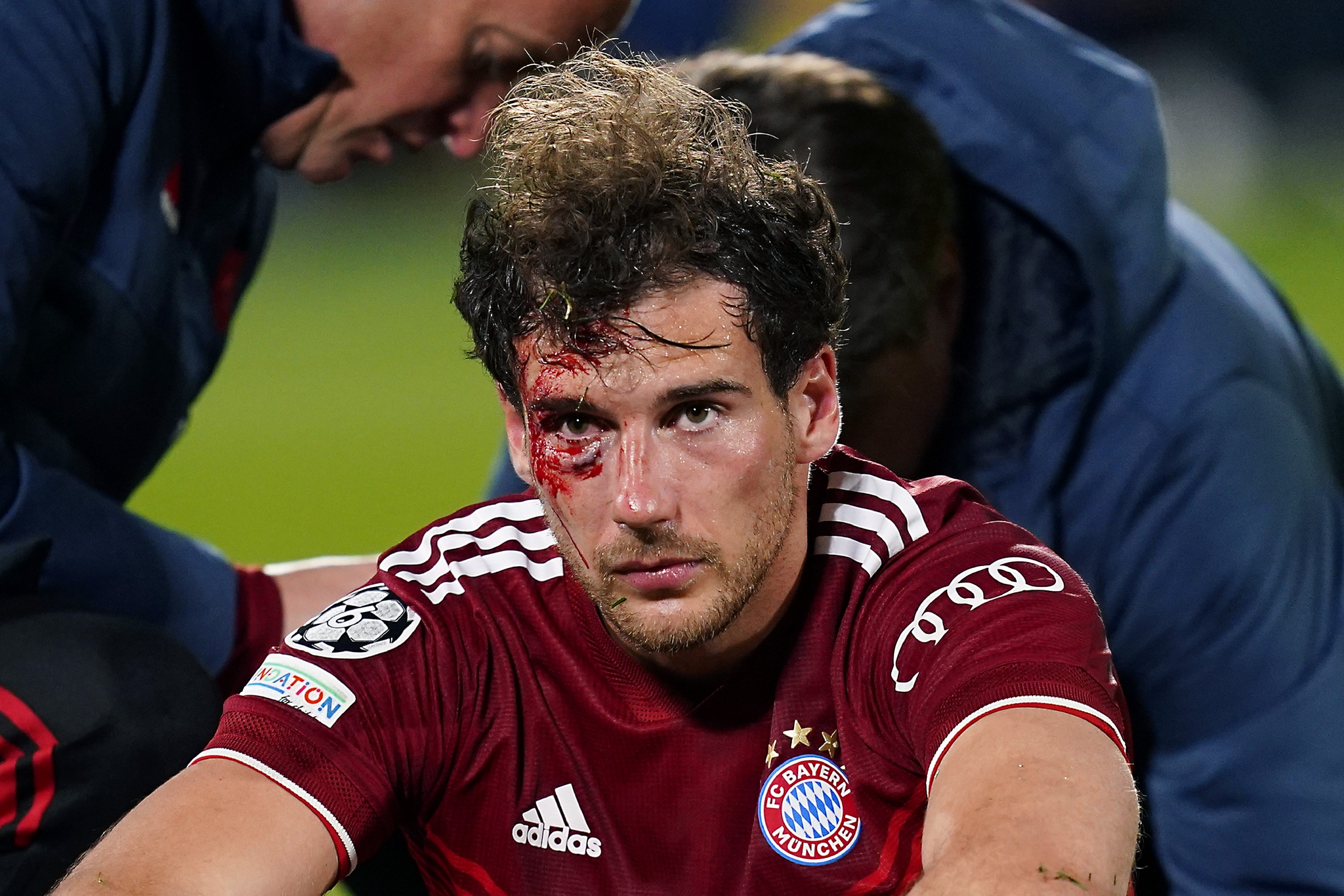 拜仁球员格雷茨卡血流满面.