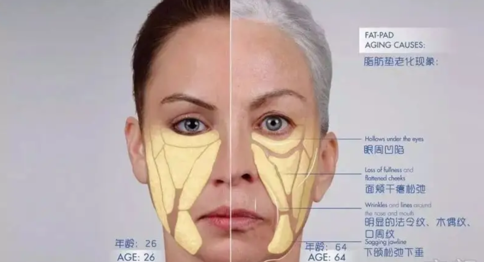 从建模脸崩成商场假人,一代神颜再露面咋成这样了…|脂肪垫|韧带|面部