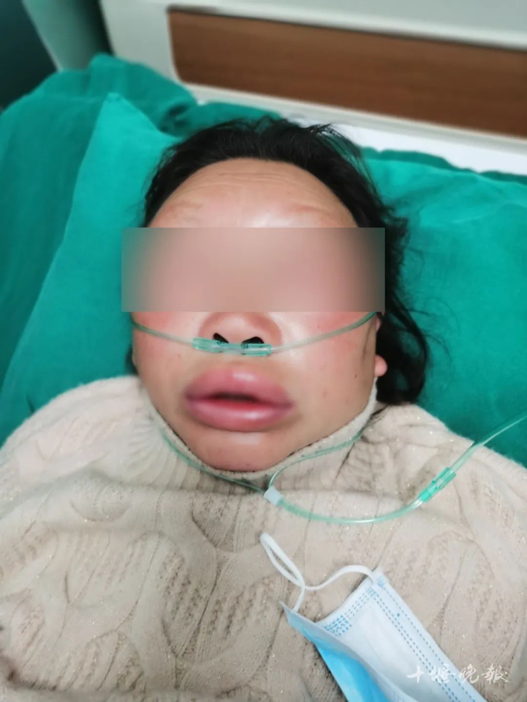 吃了它后晒太阳，十堰女子遭大罪！医生：这类人慎吃休闲区蓝鸢梦想 - Www.slyday.coM