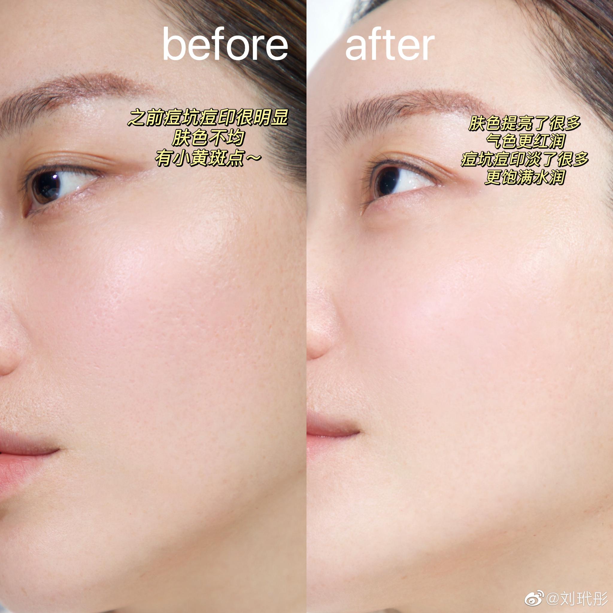 护肤分享来了—— 35岁老阿姨，皮肤还如25岁般水嫩滋润……休闲区蓝鸢梦想 - Www.slyday.coM