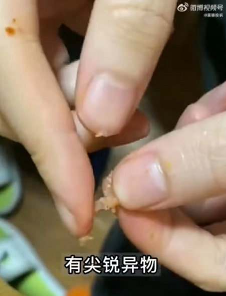 吃火腿肠刺伤舌头，双汇被骂上热搜第一！客服回应