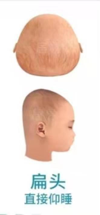 宝宝适合什么样的睡觉姿势？有这6种情况的家长要注意了休闲区蓝鸢梦想 - Www.slyday.coM